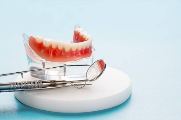 Dental Bonding in Duluth, WA